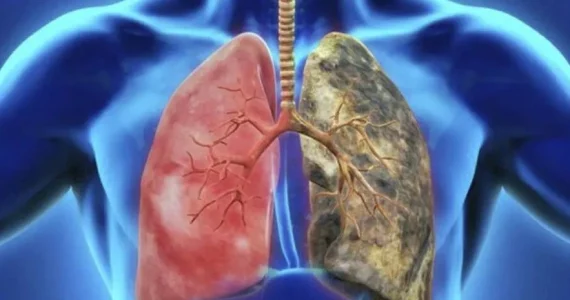 servicios-complementarios-neumologia